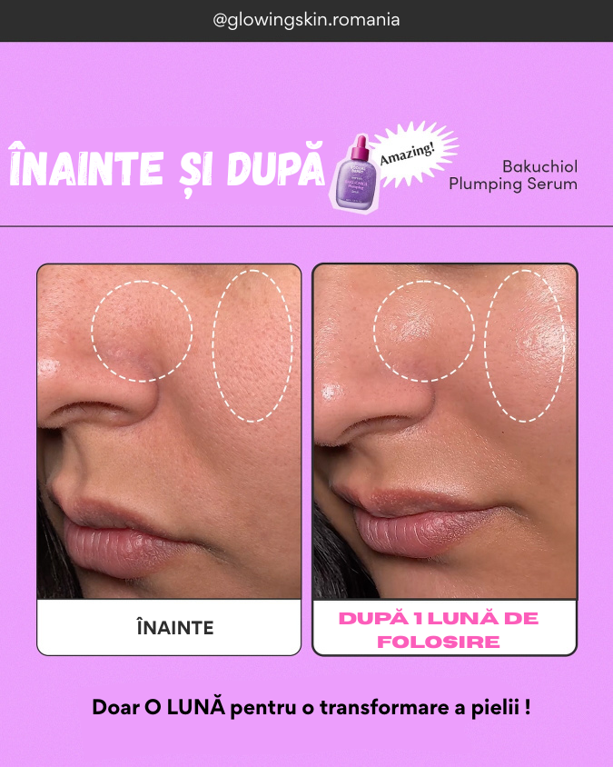 🌟 Secretul Pielii Pline și Ferme: Cum Ceramida, Niacinamida și Bakuchiolul Lucrează Împreună